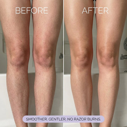 Mild Hair Removal Mousse