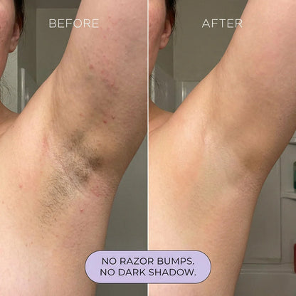 Mild Hair Removal Mousse