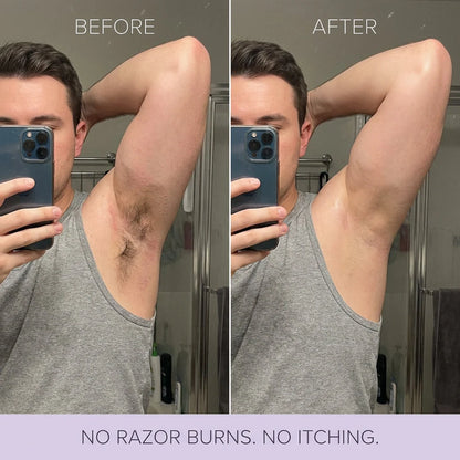 Mild Hair Removal Mousse