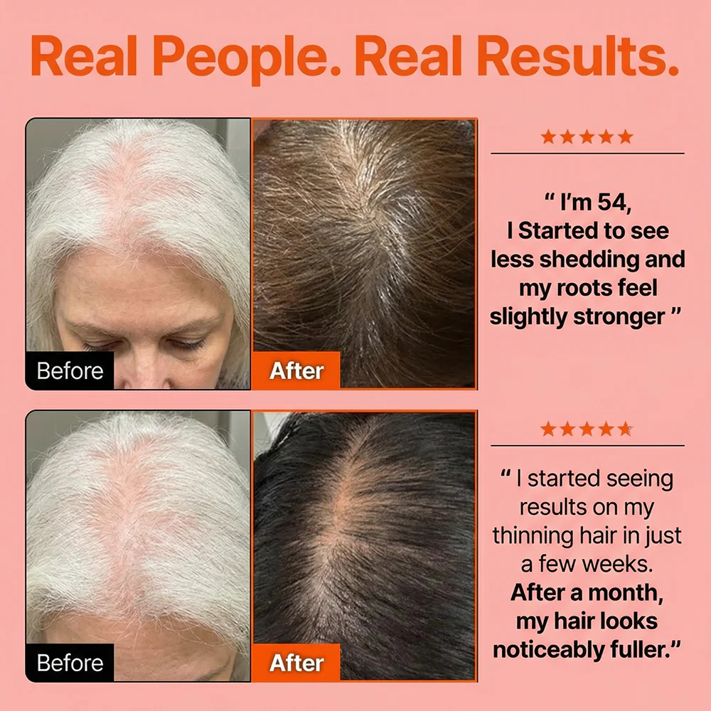 Hair Growth Serum with Massage Brush Applicator – Thickening & Hair Regrowth Scalp Treatment