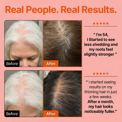 Hair Growth Serum with Massage Brush Applicator – Thickening & Hair Regrowth Scalp Treatment