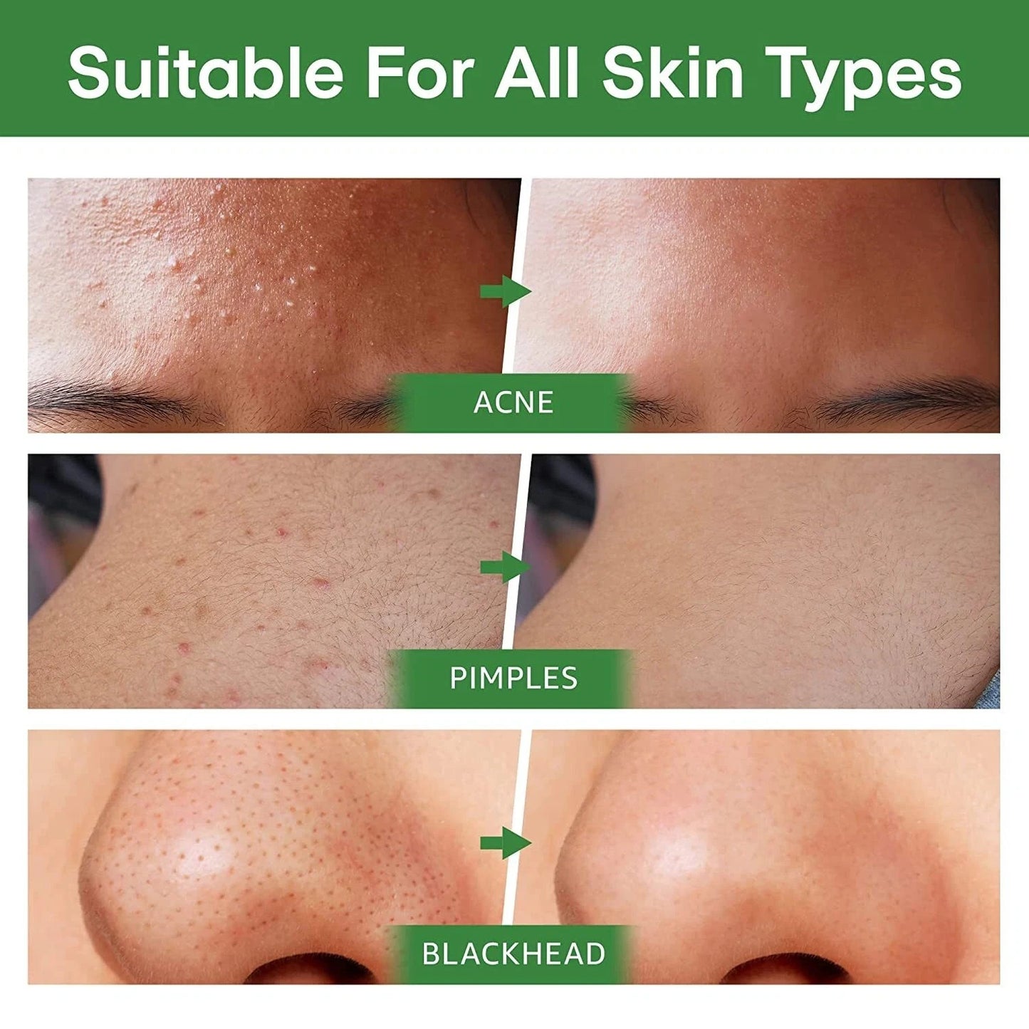 Green Tea Purifying Clay Stick Mask for Deep Clean Pore Blackhead Remover