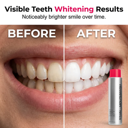 Whitening Stain Removal Mouthwash | Remove Coffee & Tea Stains